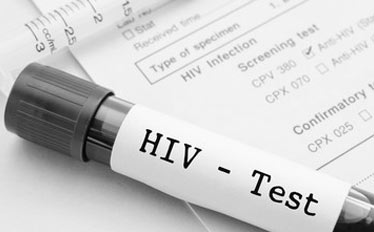HIV Screening